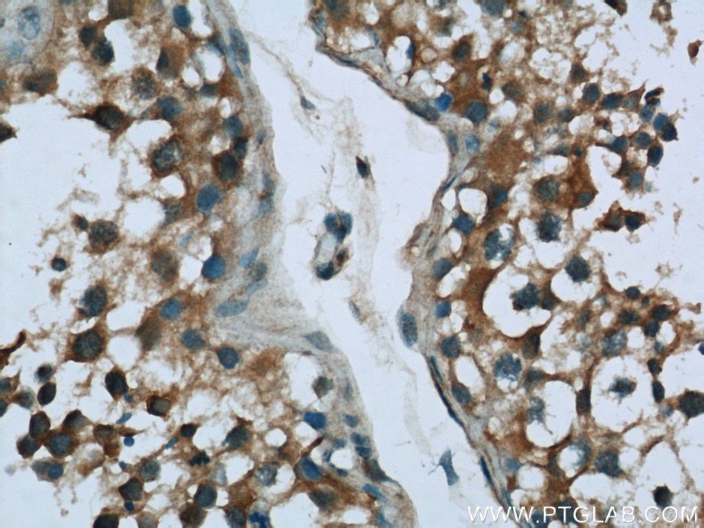 16400-1-AP;human testis tissue