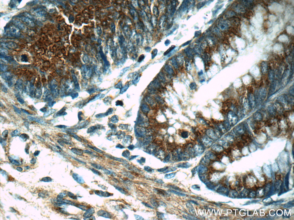 16400-1-AP;human colon tissue