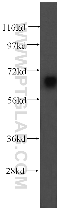 16400-1-AP;human brain tissue