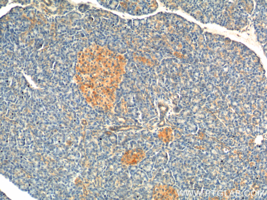 26069-1-AP;human pancreas tissue