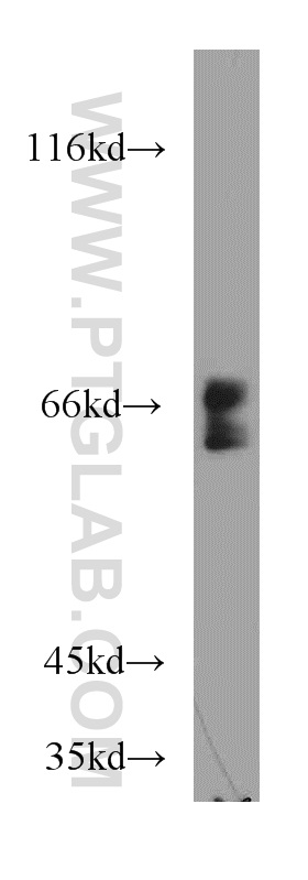 21052-1-AP;mouse heart tissue