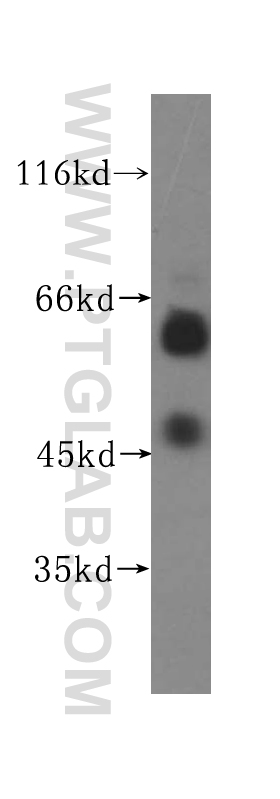 17005-1-AP;K-562 cells