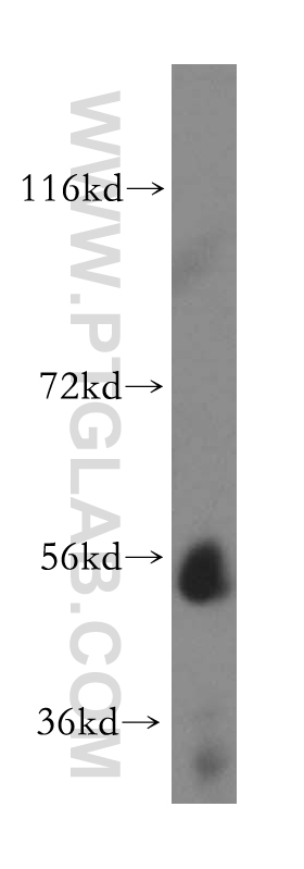 15425-1-AP;human liver tissue