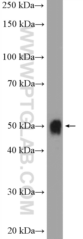 16661-1-AP;mouse liver tissue