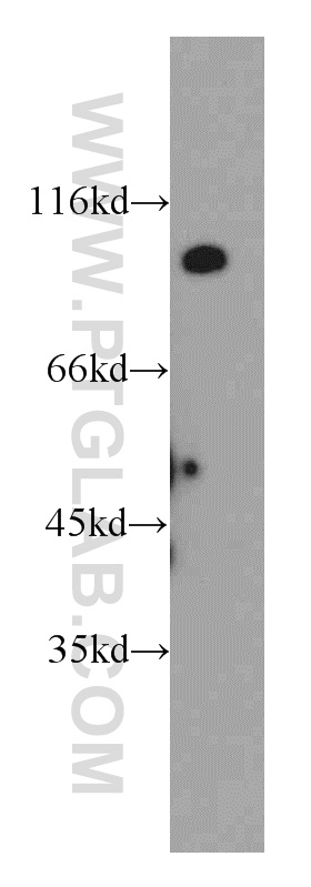 20239-1-AP;mouse brain tissue