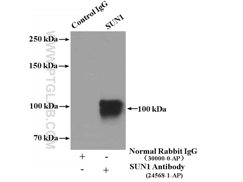 24568-1-AP;Jurkat cells