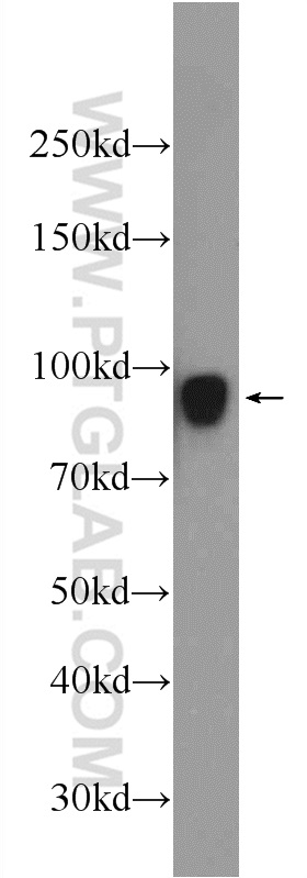 24568-1-AP;HeLa cells