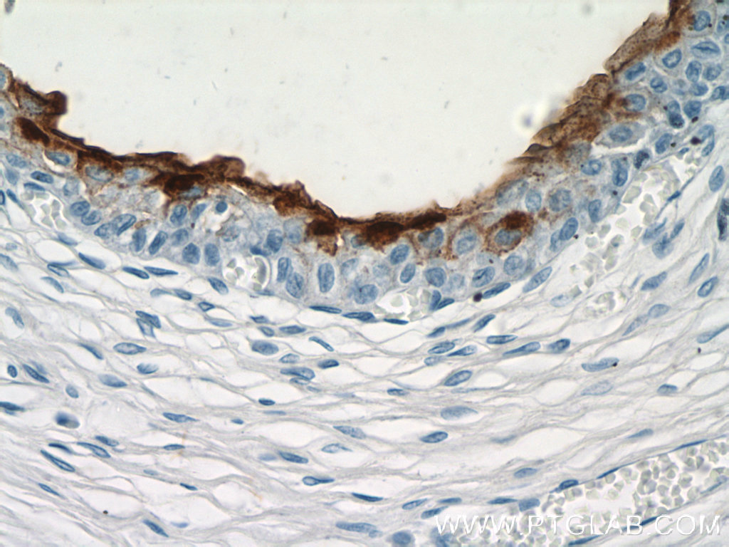 15709-1-AP;human bladder tissue