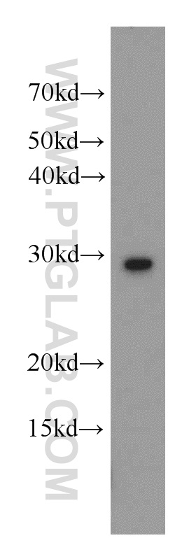 14913-1-AP;K-562 cell