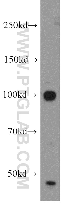 14055-1-AP;HeLa cell