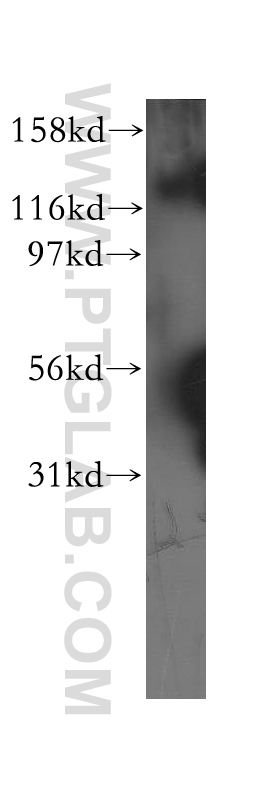 12199-1-AP;BxPC-3 cell