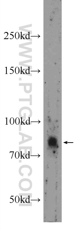 24559-1-AP;A549 cells