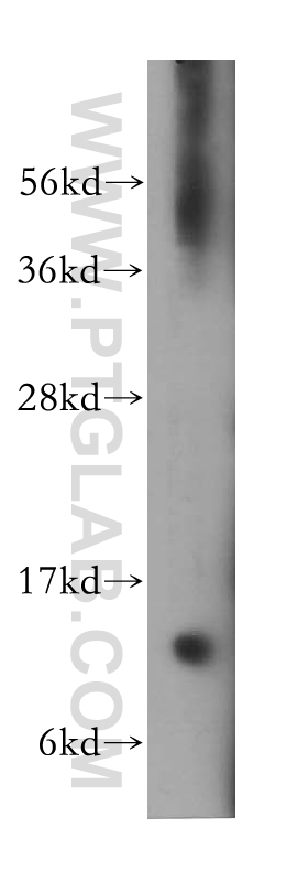 13115-1-AP;human brain tissue