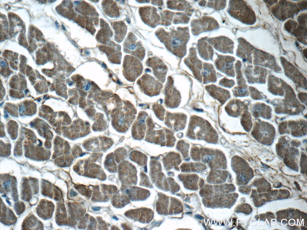 10702-1-AP;human heart tissue