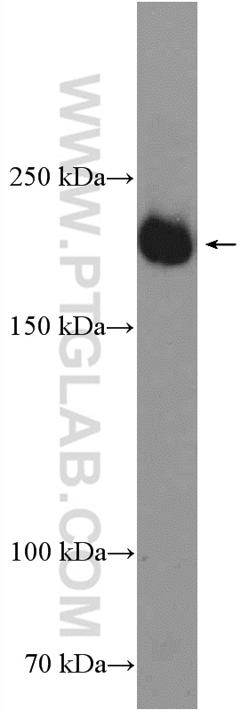 26415-1-AP;human placenta tissue