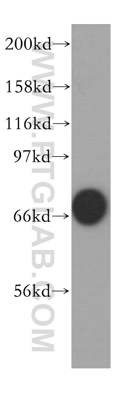 12946-1-AP;K-562 cell