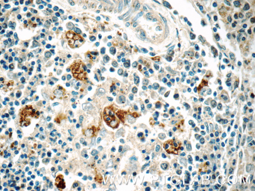 10987-1-AP;human spleen tissue