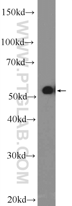 10987-1-AP;Raji cells