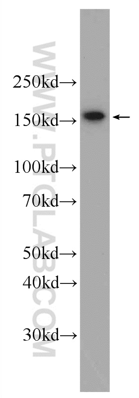 22614-1-AP;HepG2 cells