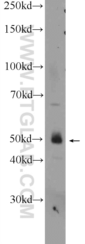 25204-1-AP;SW 1990 cells