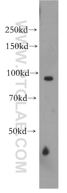 13587-1-AP;PC-3 cells