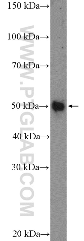 25881-1-AP;COLO 320 cells