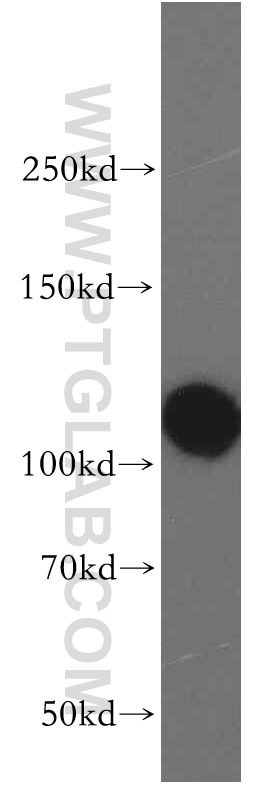 12915-1-AP;HeLa cell