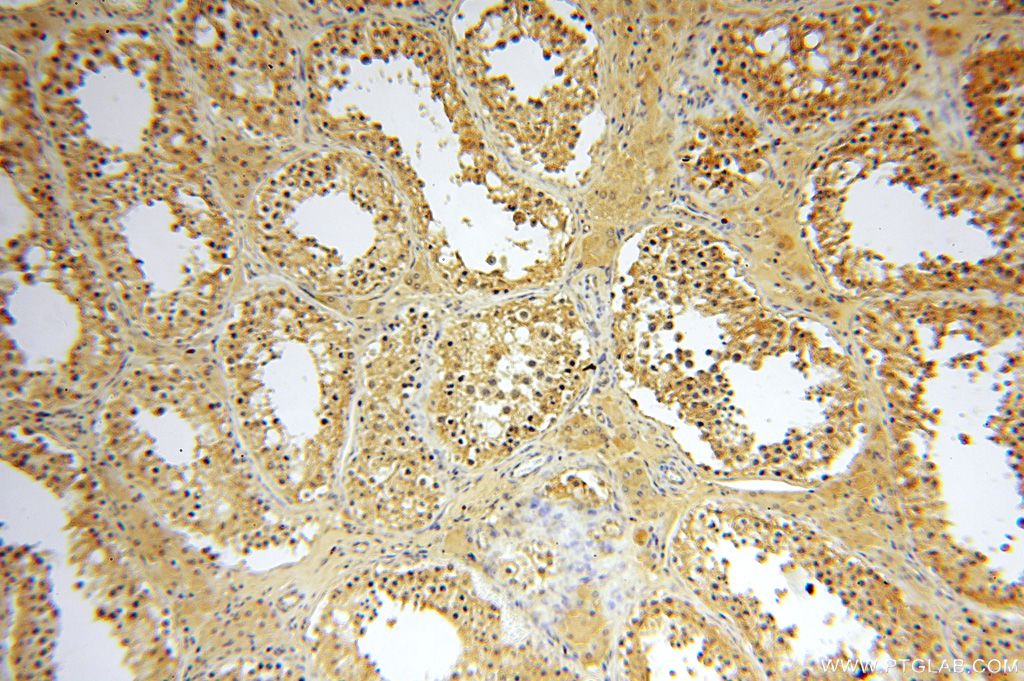 17150-1-AP;H-testis