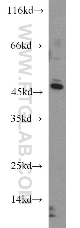 17150-1-AP;K-562 cell