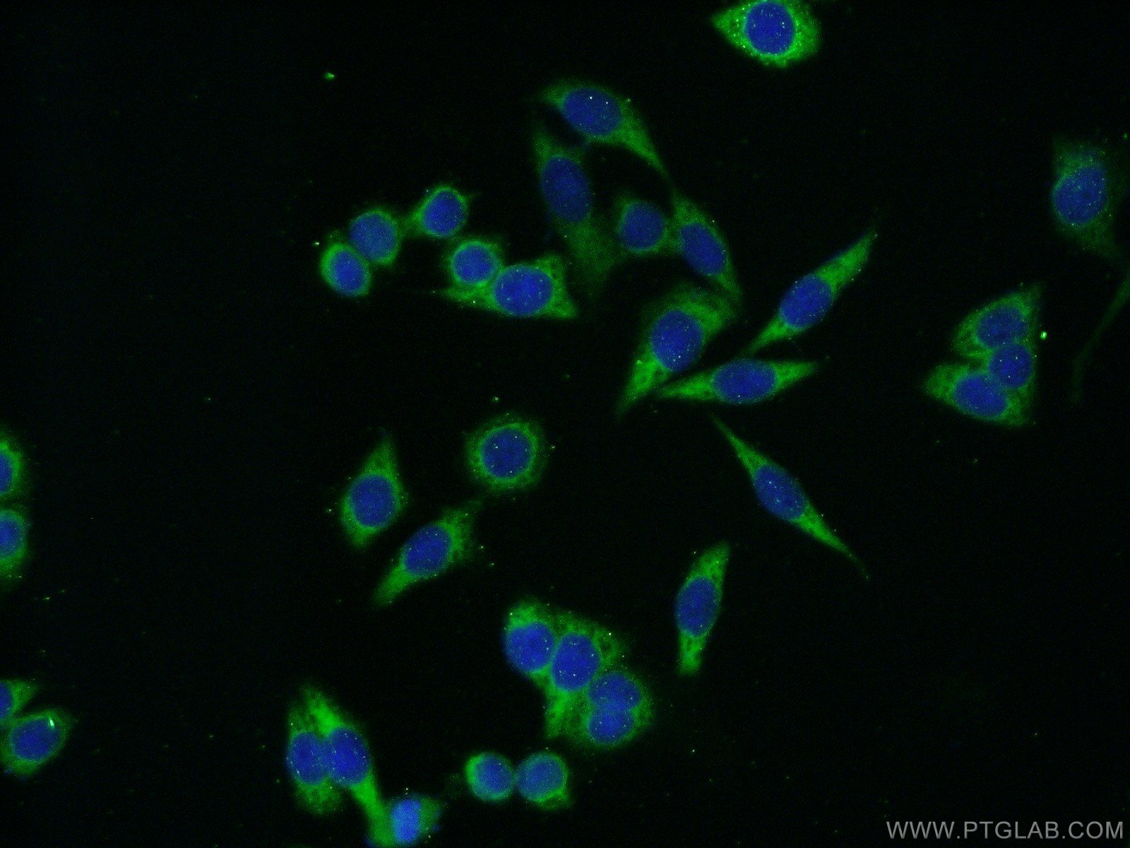 20339-1-AP;HeLa cells