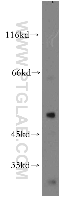 20339-1-AP;MCF7 cell