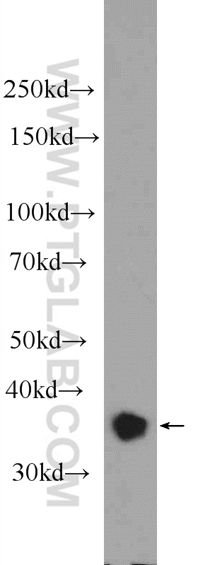 25370-1-AP;K-562 cells