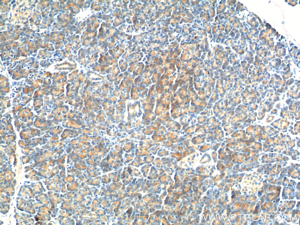 26295-1-AP;human pancreas tissue