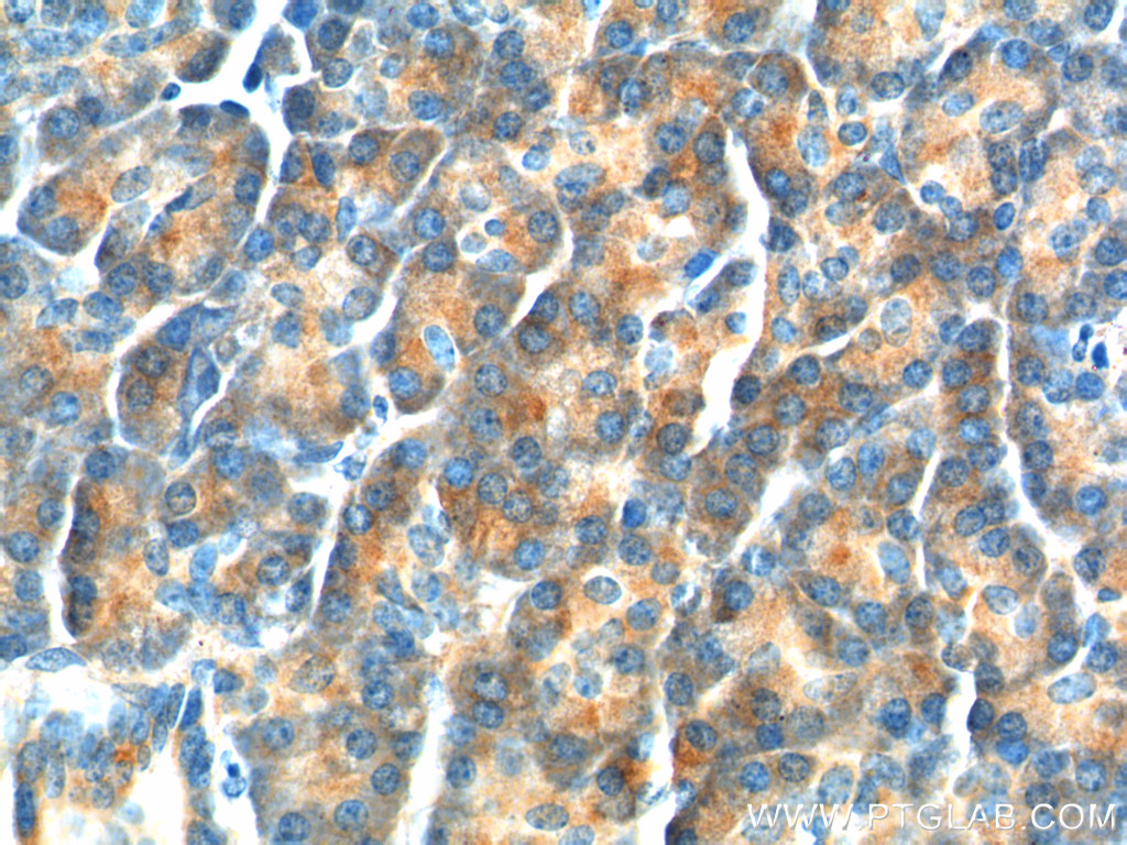 26295-1-AP;human pancreas tissue