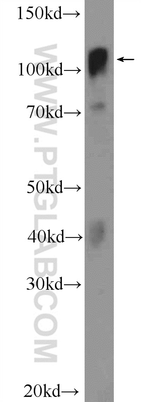 14392-1-AP;MCF-7 cells