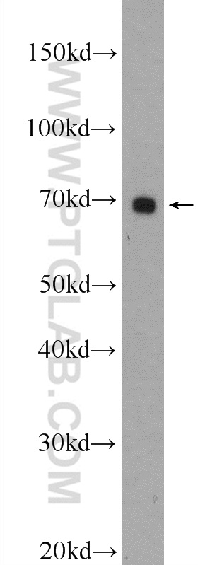 25537-1-AP;HepG2 cells