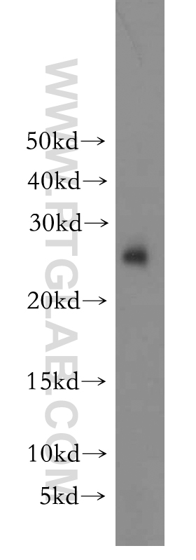 15222-1-AP;human brain tissue