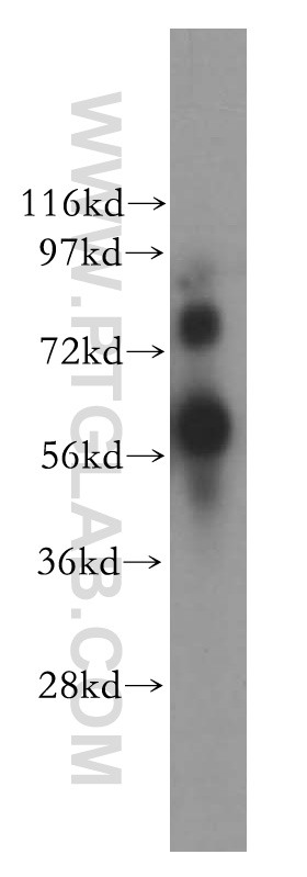 10425-1-AP;MDA-MB-231 cells