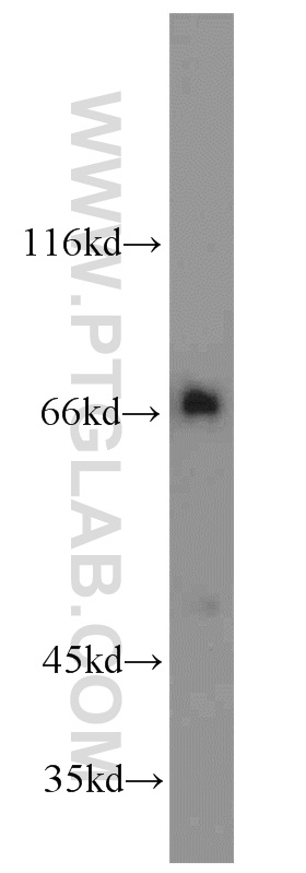 15592-1-AP;Jurkat cells