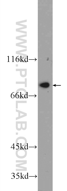 24665-1-AP;K-562 cells