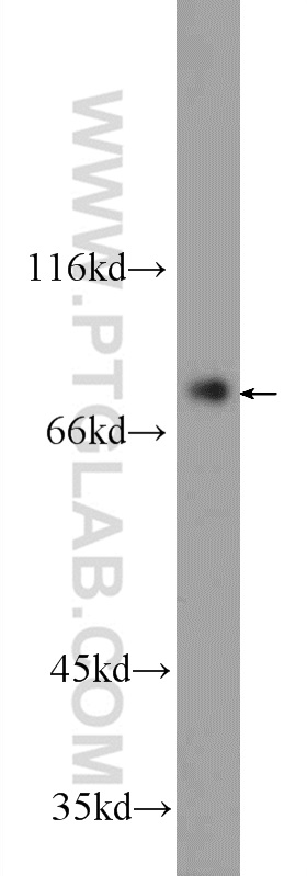 24665-1-AP;HEK-293 cells