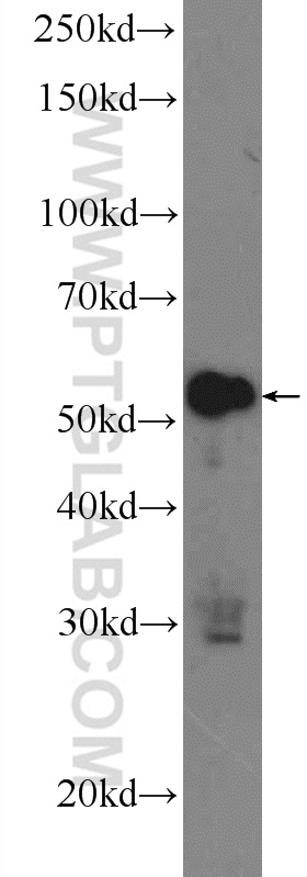 24991-1-AP;Raji cells