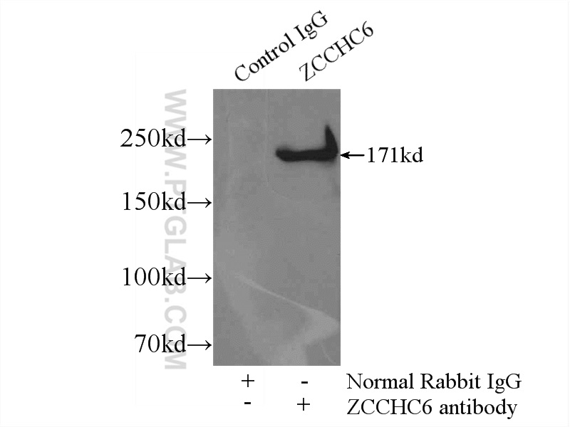 25196-1-AP;HeLa cells