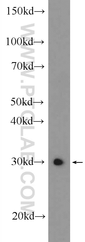 25629-1-AP;mouse testis tissue