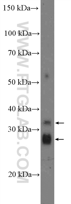 26433-1-AP;mouse stomach tissue