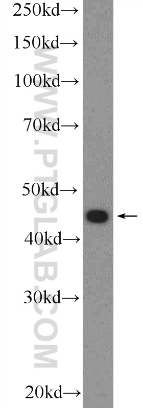 25985-1-AP;PC-3 cells