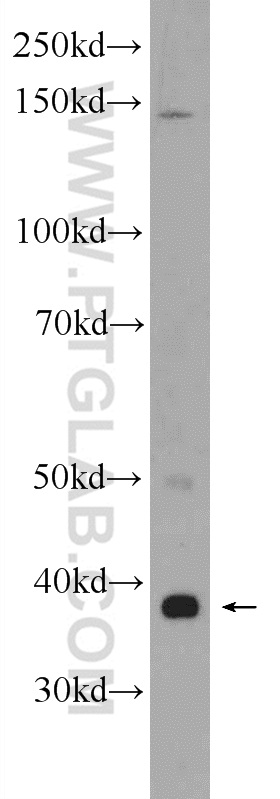 24046-1-AP;SH-SY5Y cells