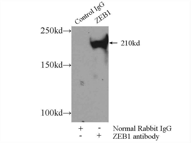 21544-1-AP;MCF-7 cells