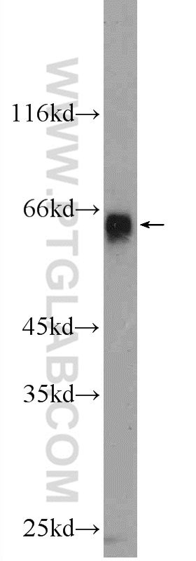 25200-1-AP;COLO 320 cells