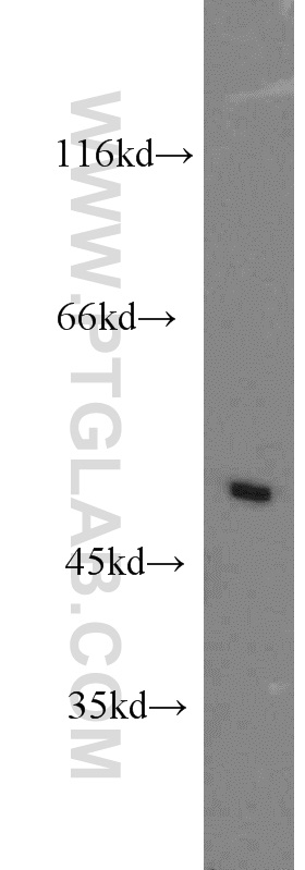 14431-1-AP;SH-SY5Y cells